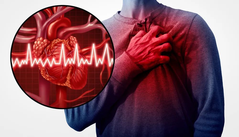 myocarditis